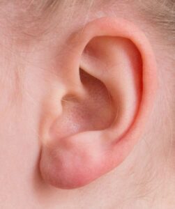 ear